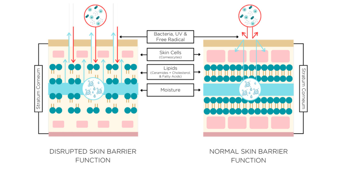 Why Your Skin Barrier Matters More Than You Think